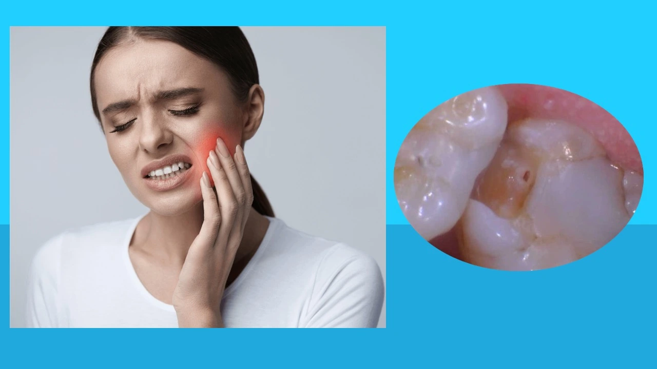 Killing Tooth Nerve Pain in 3 Seconds